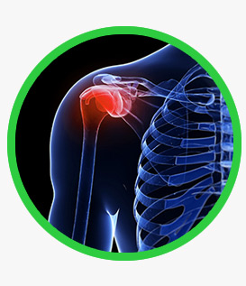 Shoulder Replacement